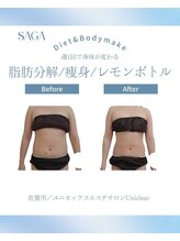 ユニクリア(Uni clear)/佐賀市痩身エステ