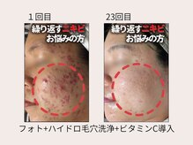 ビズビズ 天王寺店(bisebise)/本気で肌を変えたい方は当店へ