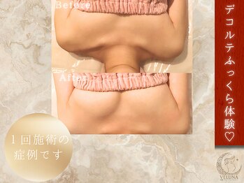ヴェルナ(VELUNA)の写真/【骨格から整える衝撃のバストケア専門店】最新機×筋膜アプローチで、オーダーメイドな施術をご提供☆