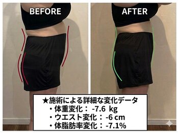 くによし整体院の写真/【本気で変えたい方限定】30-50代の減量実績多数!遺伝子検査×マンツーマンのコーチングで短期集中