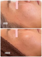 ククル(KUKULU)/ハーブ 2回目♪(40代女性)