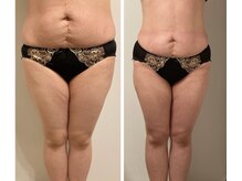 オーヴァル(Oval)/