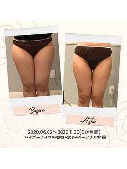 プレミアムボディケア 清水桜橋店(Premium Body Care)/お客様ビフォーアフター(下半身)