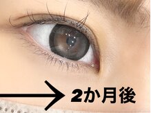 ジラッシュ(G/ash)/【フラットラッシュ100】2か月後