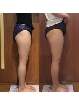 プリンセス バイ セイフティプリンセス 長野店(PRINCESS)/全身かけ放題＋リンパマッサージ