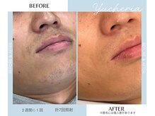 ユシェリア(Yucheria)/