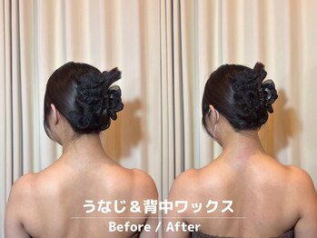 メローワックス 横浜店(MELLOW WAX)/【横浜駅/脱毛/ワックス/光】