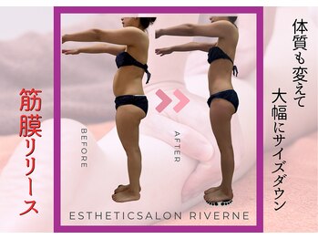 リヴェーヌ 富山店の写真/【5000人突破】リヴェーヌ式筋膜リリースは10年以上愛されるだけの結果を生み出す！