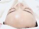 プレシャス(precious)の写真/瞬時にハリツヤUP！たるみやくすみシミでお悩みの方に！wiqo水光ピーリングで内側から輝く水光肌へ◎