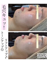 アースコアフュールボーテ ひたち野うしく店(EARTH coiffure beaute)/圧倒的透明感♪光フェイシャル
