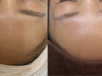 ラニブロウ(Lani brow)/艶肌アンプルワックス