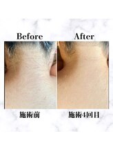 イルマーレ(Il Mare)/お客様Before&After