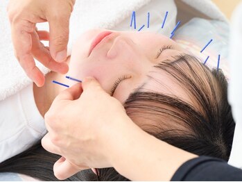 佐藤鍼灸院 美顔鍼プレム(美顔鍼PUREMU)の写真/【エラ張り・左右差・小顔ケア！】“美顔鍼”で血行を改善し、お顔のお悩みにアプローチ！