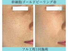 リメイククリニカルビューティー(Remake clinical beauty)/