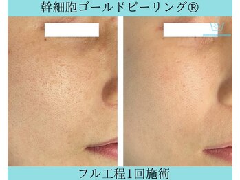 リメイククリニカルビューティー(Remake clinical beauty)/