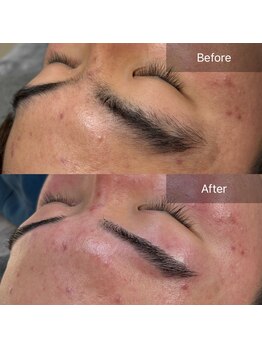 ニューミー(NEW ME)/加古川メンズ眉毛/眉毛デザイン