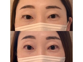 サロンドアール(salon de R)/まつ毛パーマ