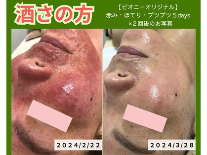 ピオニー(peony)の写真