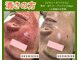 ピオニー(peony)の写真