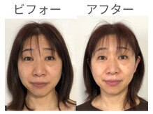 美カナエル(美kanaeru)/顔を縦にキュッと、明るい肌に♪