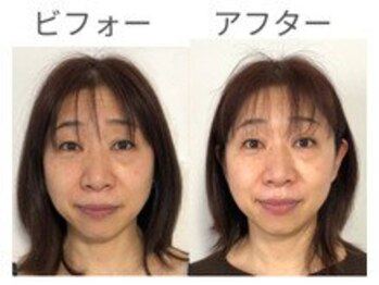 美カナエル(美kanaeru)/顔を縦にキュッと、明るい肌に♪