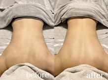 ティアモ(Ti Amo)/Before/After