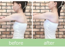 ひびきレディース整体 日吉/横顔まで美しい花嫁の美姿勢矯正