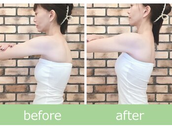 ひびきレディース整体 日吉/横顔まで美しい花嫁の美姿勢矯正