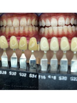 トウキョウスワーズ 池袋店(TOKYO SWRS)/#ホワイトニング #池袋 #渋谷