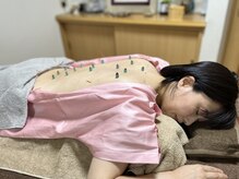 ほがら鍼灸マッサージ