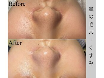 ブラックボックス(BLACK BOX)/20代女性のお客様