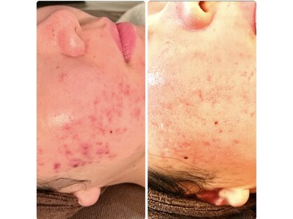 ビーアンドアイ シズオカテン メンズ(B＆I SHIZUOKA)の写真