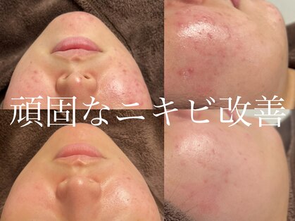 リッチ(Rich)の写真