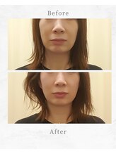 リファイン整体院 国分寺店/小顔、骨盤、ヘッドスパ、整体