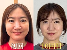 鍼灸院グロリアス 銀座(Glorious)の雰囲気（【B&A写真】黄金比デザインで、あなた本来の美しさへ！）