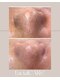 プリエ(Prier)の写真/長年溜めこんだカチカチ黒ずみ&角栓根っこから取り出す!<毛穴丸ごと洗浄×ハイドロスキン角質・角栓除去>