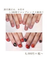ネイルサロン アニーアンドジーノ シド(NAIL SALON Annie&Gino shido)/深爪矯正はお任せ！