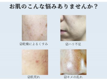 デジックスプラス(Digix+)/【エステ】