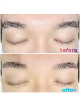 アース 津田沼店(EARTH Eye & Aesthetic)/ハリウッドブロウリフト(HBL)