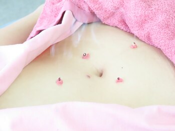 明大前はり灸院/妊活or温活