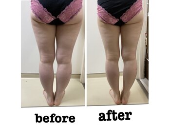 ラウレア 松山店(LAULEA)/たった10分で効果絶大◎