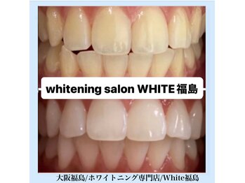 ホワイトニングサロン ホワイト(WHITE)/セルフホワイトニング/大阪/福島