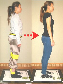 チャラク(charaku)/【35歳Ｎ様：全身矯正+痩身】