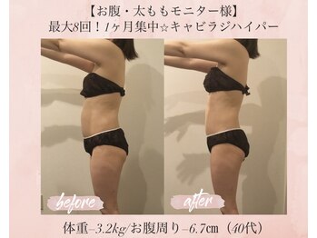 オキシー グレイス 小倉店(OXY Grace)/40代お客様ビフォーアフター