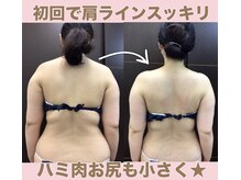 スワン 新栄店(SWAN)/初回の効果★オーダーメイド痩身