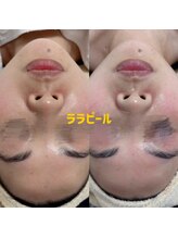 クリーン&ビューティー/ララピール／水光ツヤ肌/女優肌