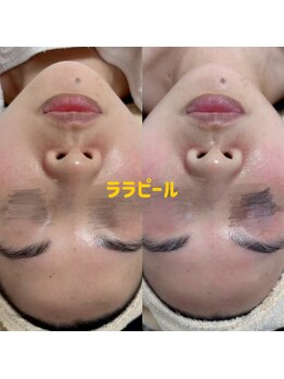 クリーン&ビューティー/ララピール/水光ツヤ肌/女優肌