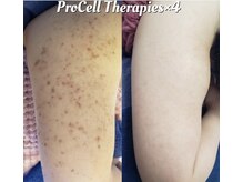 エイミー(Amy)の雰囲気(二の腕のブツブツにも大人気★)