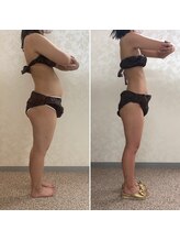 ビューティービューティー(beauty×beauty)/1ヶ月集中サイズダウンコース