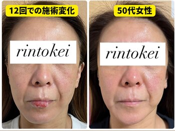 凛と慶/長居-美容鍼・ダイエット